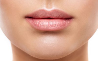 Labios con ácido hialurónico